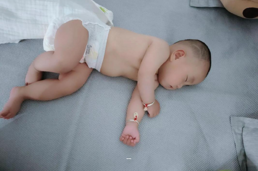 涟源宝宝脸上有白色斑块